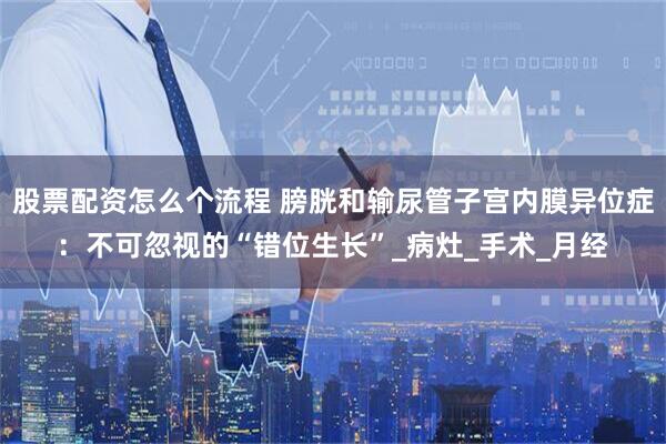 股票配资怎么个流程 膀胱和输尿管子宫内膜异位症：不可忽视的“错位生长”_病灶_手术_月经